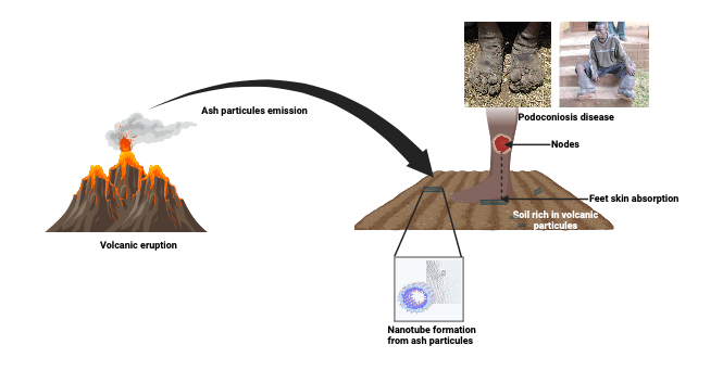 Volcanic Soils Evolution and Podoconiosis